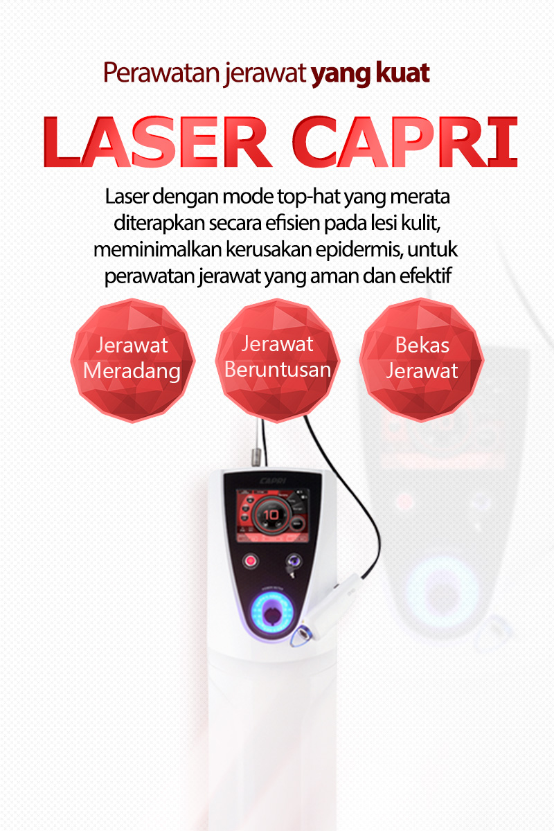 Capri Laser - Nampo
