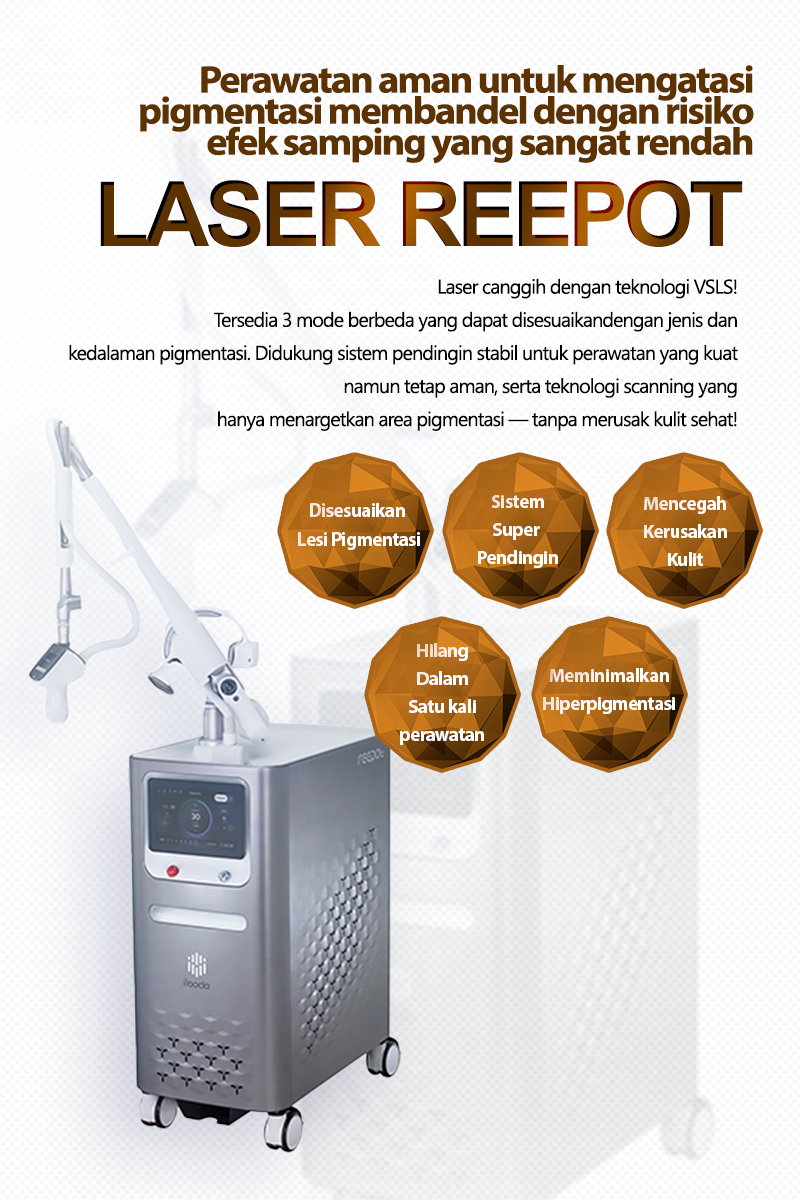 Reepot Laser - Nampo