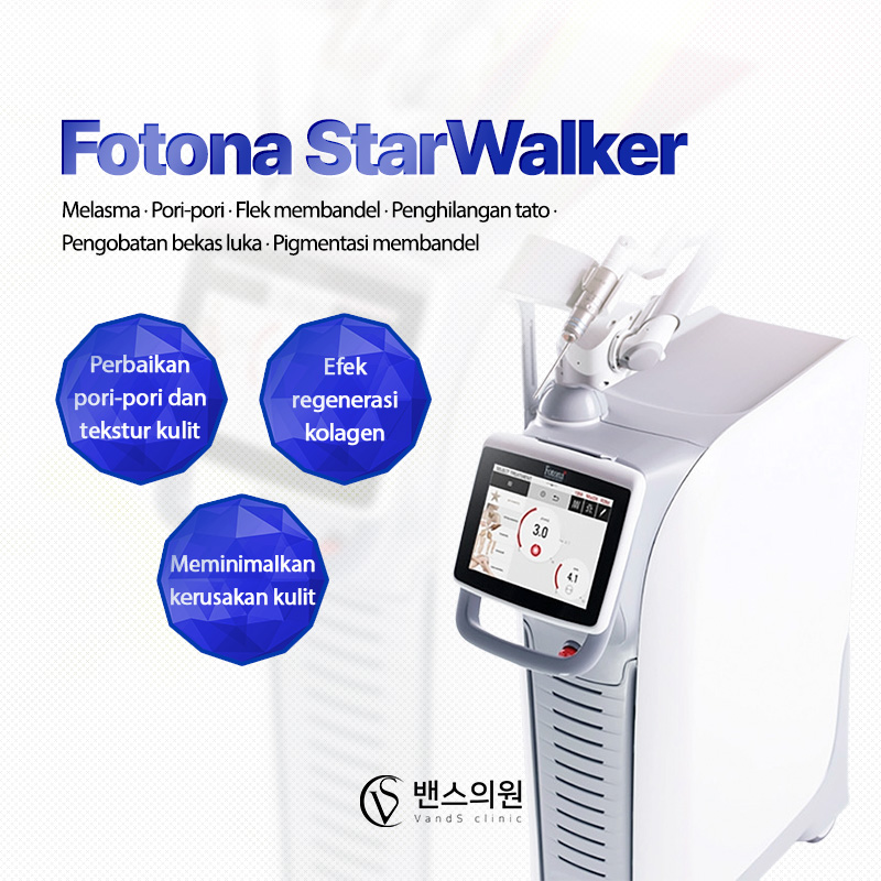 Fotona StarWalker - Nampo